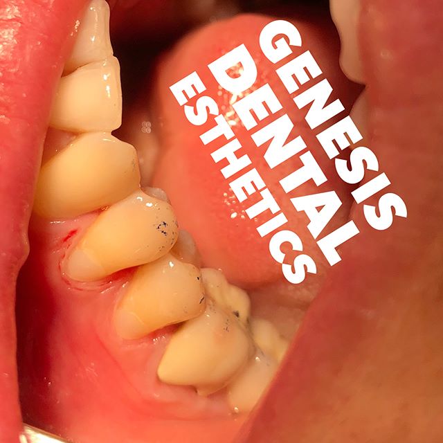 Cosmetic and general dentistry in San Marino