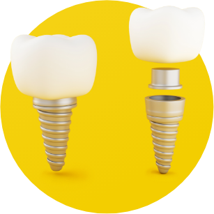 Dental Implant Genesis Dental Arts