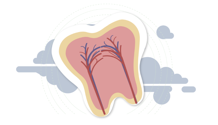 Root Canal Treatment San Marino