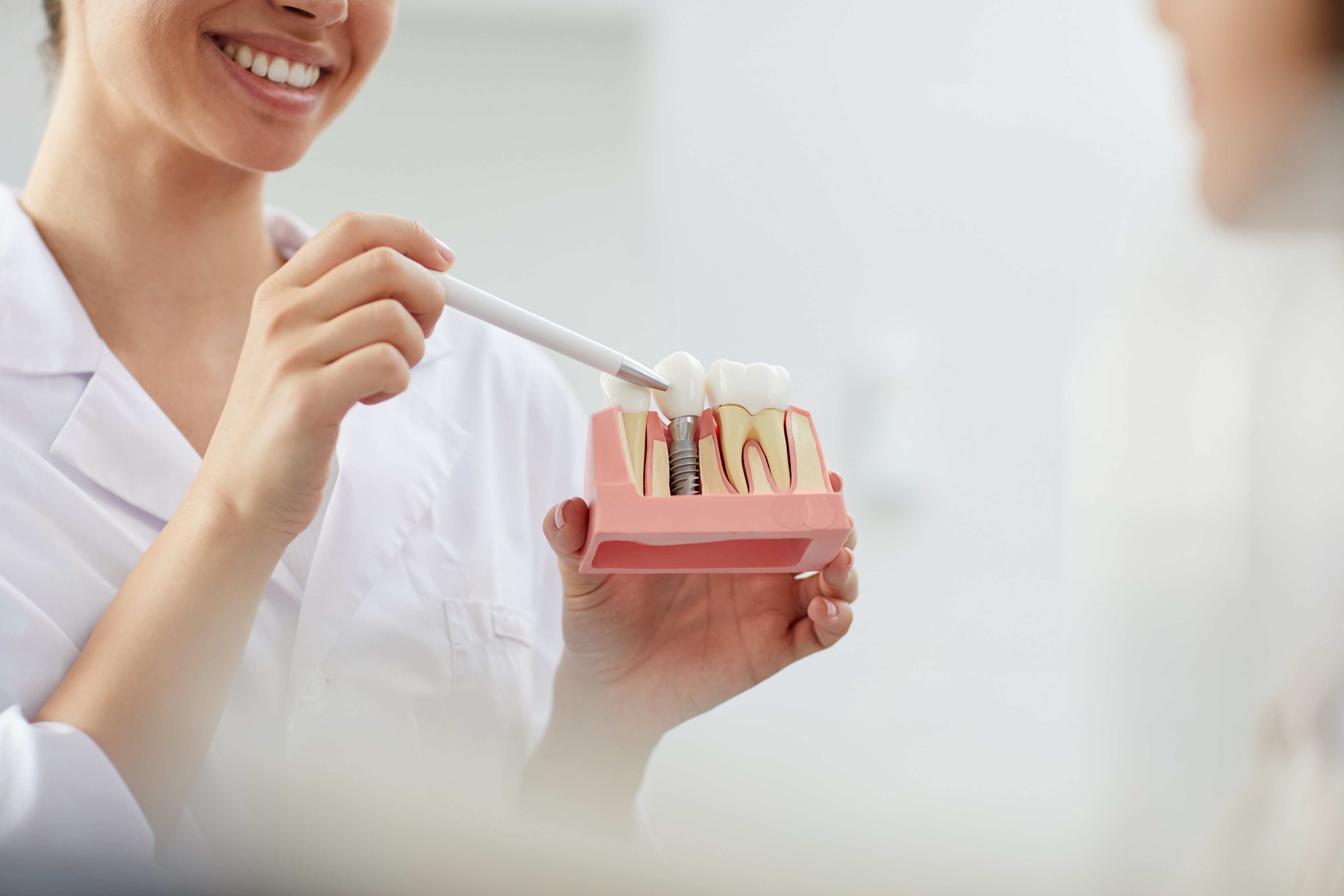 Dental implants near Alhambra, CA
