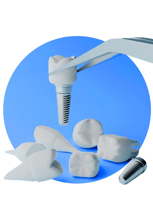 Dental Implants