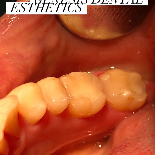 Cosmetic and general dentistry in San Marino