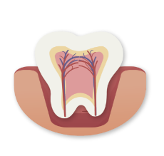 Root Canal case San Marino